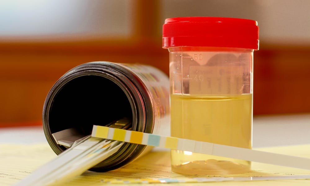 Understanding Synthetic Urine Features Before Making an Informed Purchase