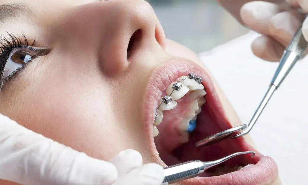 Root Canal Treatment or Tooth Extraction? Understanding the Options for an Infected Tooth